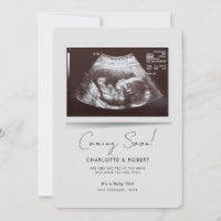 Bientôt bébé numérisation grossesse
