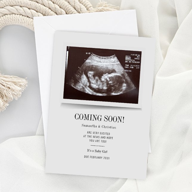 Faire-part de grossesse ultrasonique moderne (Custom Baby Announcement Sonogram Ultra Scan Photo)