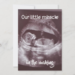 Faire-part Little Miracle Ultrasound 2 Photo Baby Family