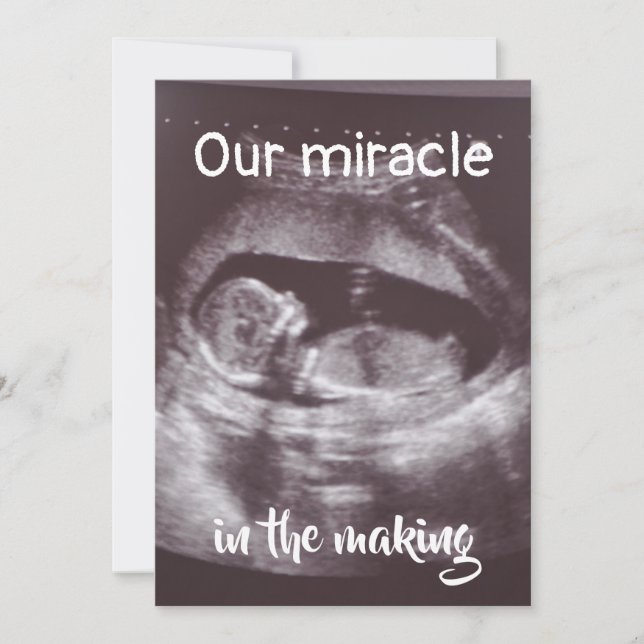 Faire-part Miracle In Making Ultrasound 2 Photo Baby Family (Devant)