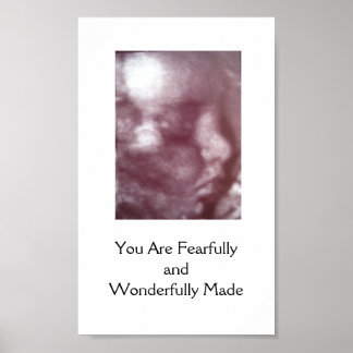 Fearful and Wonderful Fade / Poster