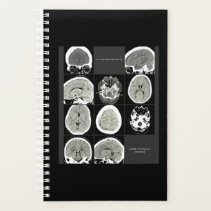 FullCTScan_thiswhatdepressionslike