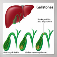 Galeries et Poster du foie