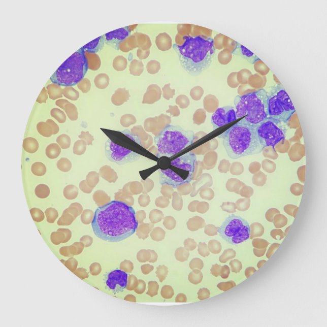 Grande Horloge Ronde Laboratoire d'hématologie du microscope à diaposit (Recto)