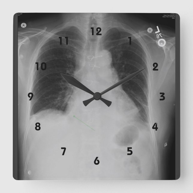 Horloge Carrée Chest X Ray (Recto)