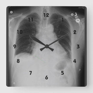 Horloge Carrée Chest X Ray