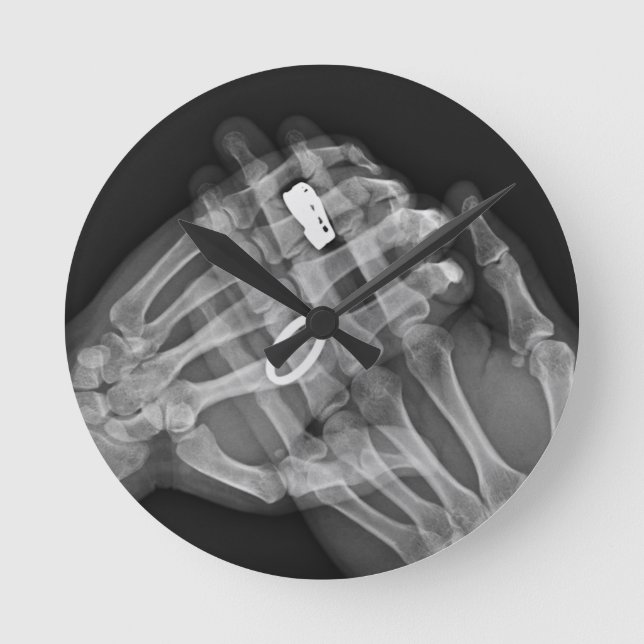 Horloge Ronde Hand (Recto)