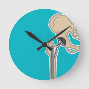 Horloge Ronde Remplacement d'articulation de la hanche