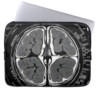Housse Pour Ordinateur Portable Analyse cérébrale par IRM