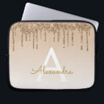 Housse Pour Ordinateur Portable Boule d'or | Monogramme de Parties scintillant éti<br><div class="desc">Gold Bling Ombre Sparkle et Faux Dripping Parties scintillant Girly Moderne Monogramme Prénom et Coque d'ordinateur portable initial. Veuillez contacter le concepteur pour les articles correspondants</div>