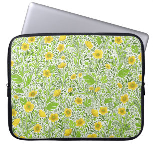 Housse Pour Ordinateur Portable Boutons blancs