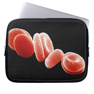 Housse Pour Ordinateur Portable Globules rouges