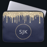 Housse Pour Ordinateur Portable Monogramme de Parties scintillant bleu marine d'or<br><div class="desc">Parties scintillant d'or et de flûtes bleu marine personnalisées et Coque d'initiaux monogrammes étincelants. Ce coque peut être customisé pour inclure votre nom initial et prénom.</div>