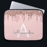 Housse Pour Ordinateur Portable Parties scintillant or rose rose vierge Étincelle<br><div class="desc">Rose Bleu - Rose Gold Faux Dripping Parties scintillant Fille moderne et élégant et Élégant Coque Monogramme Élégant. Ce coque peut être customisé pour inclure votre nom initial et prénom.</div>