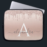 Housse Pour Ordinateur Portable Parties scintillant rose Rose or et Monogramme éti<br><div class="desc">Parties scintillant Rose Rose Gold Faux et Coque Monogramme élégant étincelant. Ce coque peut être customisé pour inclure votre nom initial et prénom.</div>