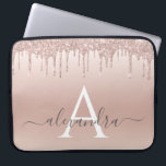 Housse Pour Ordinateur Portable Parties scintillant rose Rose or et Monogramme éti<br><div class="desc">Parties scintillant Rose Rose Gold Faux et Coque Monogramme élégant étincelant. Ce coque peut être customisé pour inclure votre nom initial et prénom.</div>