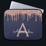 Housse Pour Ordinateur Portable Rose Rose Rose Gold Marine Parties scintillant ble<br><div class="desc">Rose Rose Or et Navy Blue Faux Dripping Moderne et élégante Parties scintillant fille et Coque de Monogramme élégant étincelant. Ce coque peut être customisé pour inclure votre nom initial et prénom.</div>