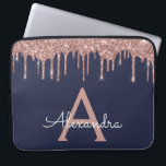 Housse Pour Ordinateur Portable Rose Rose Rose Gold Marine Parties scintillant ble<br><div class="desc">Rose Rose Or et Navy Blue Faux Dripping Moderne et élégante Parties scintillant fille et Coque de Monogramme élégant étincelant. Ce coque peut être customisé pour inclure votre nom initial et prénom.</div>
