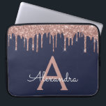 Housse Pour Ordinateur Portable Rose Rose Rose Gold Marine Parties scintillant ble<br><div class="desc">Rose Rose Or et Navy Blue Faux Dripping Moderne et élégante Parties scintillant fille et Coque de Monogramme élégant étincelant. Ce coque peut être customisé pour inclure votre nom initial et prénom.</div>