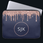 Housse Pour Ordinateur Portable Unités de Parties scintillant d'or Rose bleu marin<br><div class="desc">Girly Blush Pink - Rose Gold et bleu marine  Faux Parties scintillant Drips et Élégant Parkle Monogrammed Initials Coque. Ce coque peut être customisé pour inclure votre nom initial et prénom.</div>