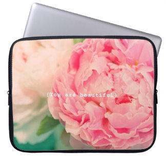 Housse Pour Ordinateur Portable Vous êtes beaux