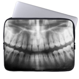Housse Pour Ordinateur Portable X-Ray Teeth Bouche sourire noir et blanc