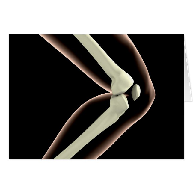 Image X-Ray Du Genou 1 (Devant horizontal)