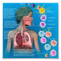 Allergies : affiche de réponse inflammatoire IgE