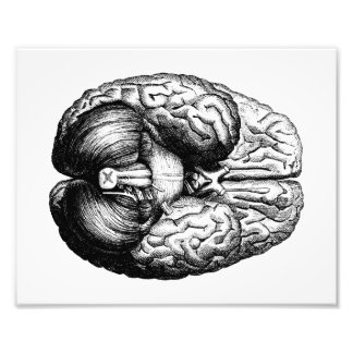 Impression Photo Cerveau anatomique
