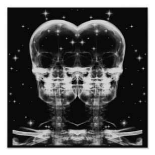 Impression Photo Double crâne à rayons X - noir et blanc