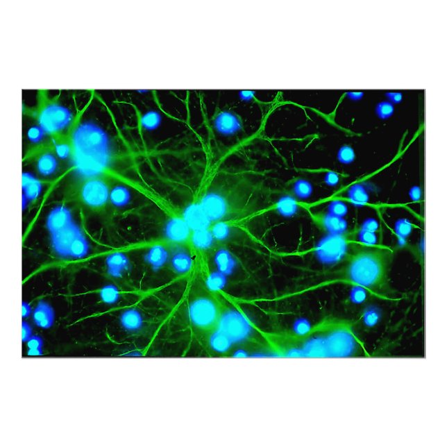 Impression Photo Les Astrocytes sont des cellules globulaires en fo (Devant)