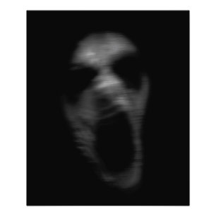 Impression Photo Pertes de troubles mentaux