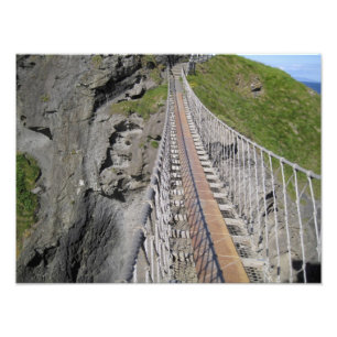 Impression Photo Pont de corde historique de Carrick-a-rede, Nord