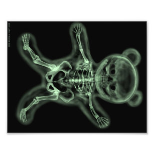 Impression Photo Squelette de rayons X d'une affiche pop art d'un o