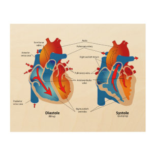 Impression Sur Bois Organigramme Médicale du flux sanguin cardiaque
