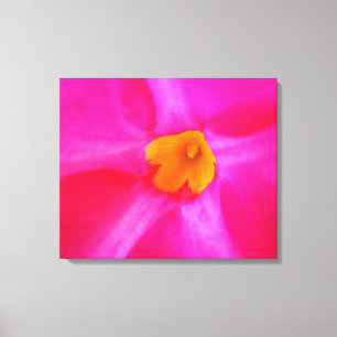 Impression sur toile tendue