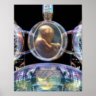 Impression systématisée