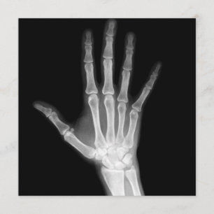 Invitation Bras squelettiques noir et blanc de rayon X