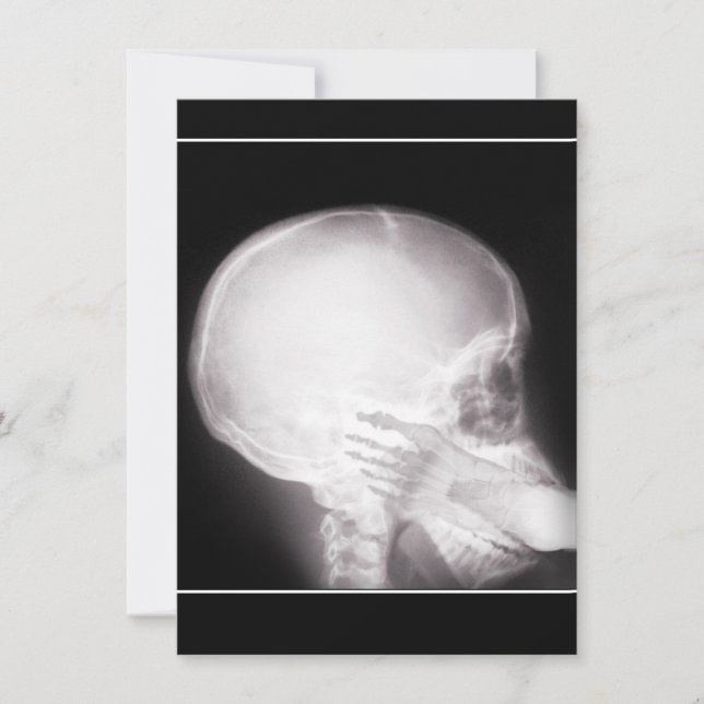 Invitation de prescription avec pied dans la bouch (Devant)