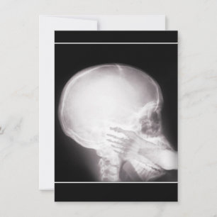 Invitation de prescription avec pied dans la bouch