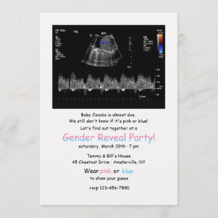 Invitation Doppler foetal Image Gender Revevela Party Invitat