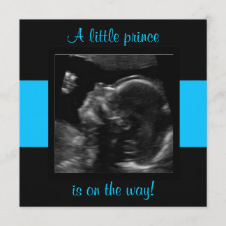 Invitation Garçon Baby Customisé Modèle photo Ultrasound