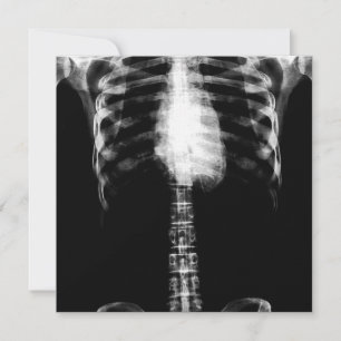 INVITATION RIBS DE TORSE DE SQUELETON X-RAY - B&W
