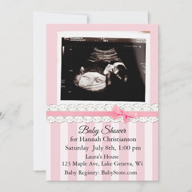 Invitations personnalisées Ultrasound Baby Shower (Devant)