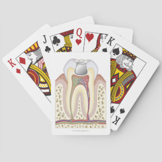 Jeu De Cartes Illustration de plombage dentaire