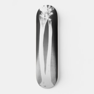 Le skateboard Breaks de Bradley Boness