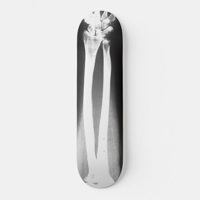 Le skateboard Breaks de Bradley Boness (Recto)