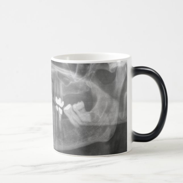 Magic Gros sourire Morpher Mug (Droite)
