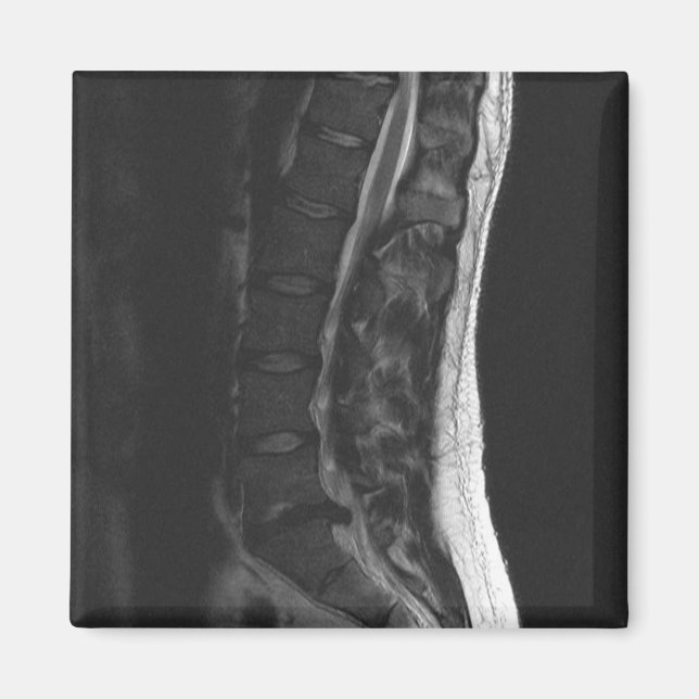 Magnet de disque en série (Devant)