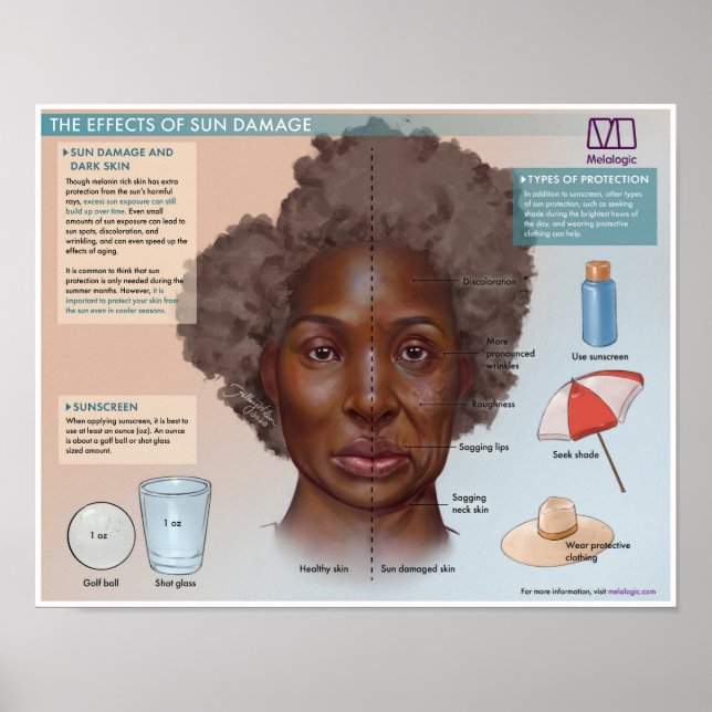 Mélogique Les effets des dommages au soleil Poster (Devant)